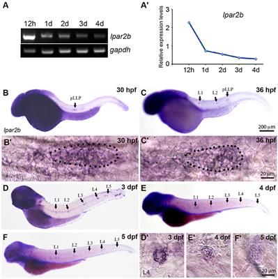 Lpar2b Controls Lateral Line Tissue Size by Regulating Yap1 Activity in Zebrafish